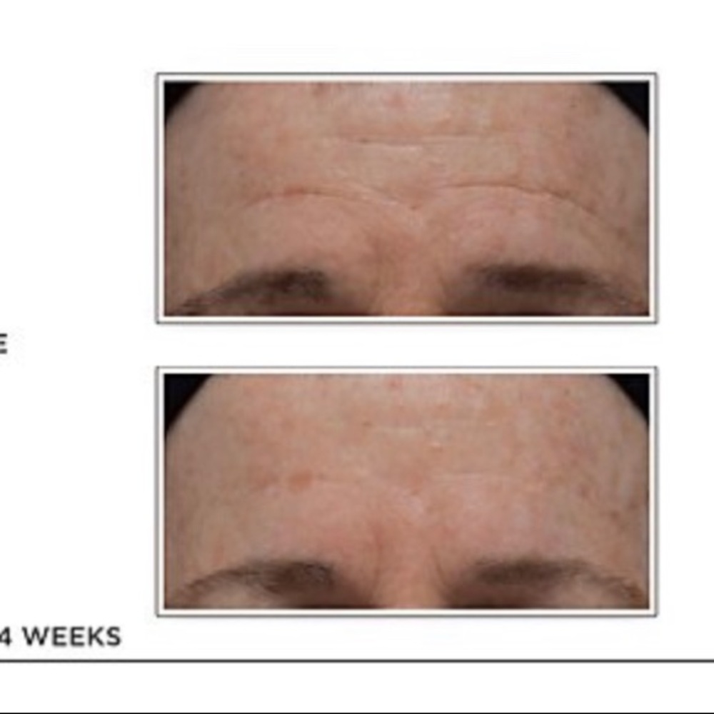 🚨SOLD🚨 - Picture 5 of 6